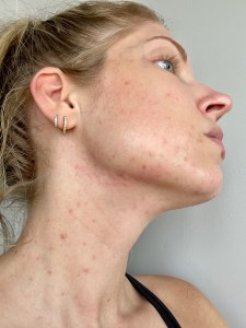 skincare routine
